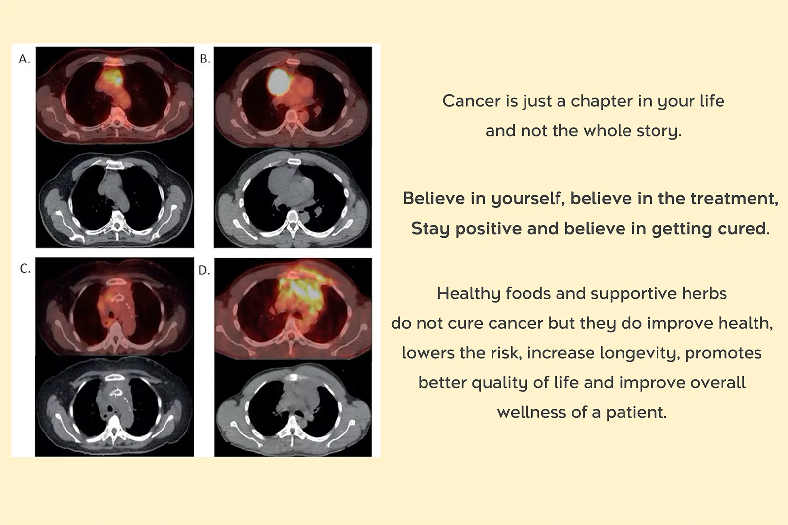 Cancer: Supportive Care at Ultimate Life